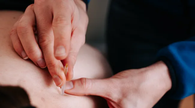 Dry Needling